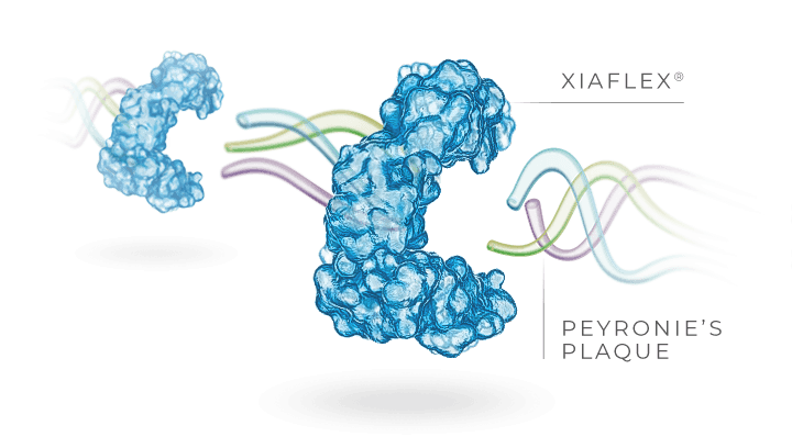 XIAFLEX® weakens and breaks down complex bonds that hold Peyronie’s plaque together