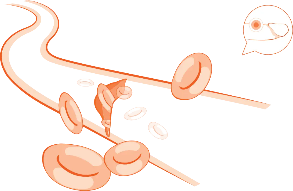 An illustration of a blood vessel rupturing in a penis