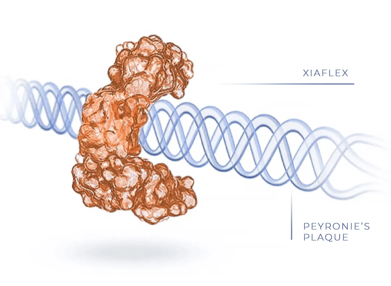 An illustration of XIAFLEX attaching to the fibers of the Peyronie’s plaque